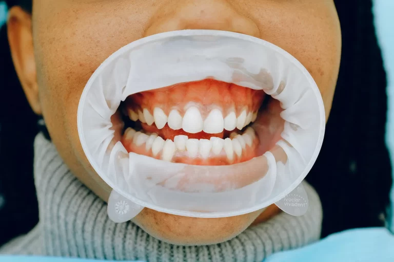 How Gum Health Affects Your Overall Health